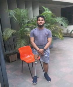 A young man standing with his false leg.