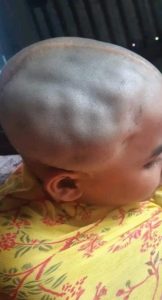 A head injury patient