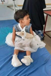 A little girl is sitting on a hospital bed with a bandage in her left hand and both legs.