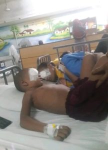 A little girl is lying on a bed with a bandage in her right eye and a cannula in her right hand.