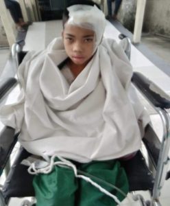 A girl sitting on a wheelchair after her neurosurgery.